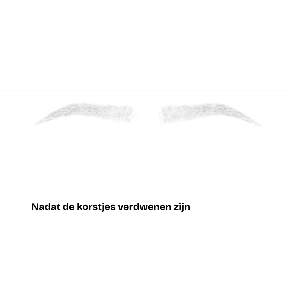 Flauwe, dunne wenkbrauwen op een witte achtergrond met daaronder de Nederlandse tekst Nadat de korstjes verdwenen zijn, perfect om de resultaten van poederwenkbrauwen of lipblush te laten zien.