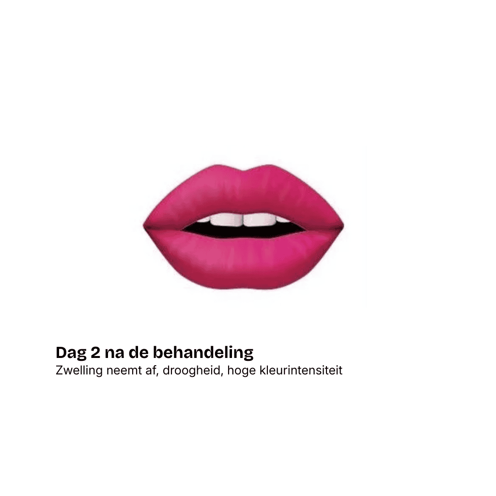 Een illustratie van roze lippen die lichtjes gesepareerd zijn en witte tanden tonen. Daaronder staat de Nederlandse tekst: Dag 2 na de behandeling. Zwelling neemt af, droogheid, hoge kleurintensiteit-post-behandeling lipblos veranderingen bij onze beautysalon in Schijndel.